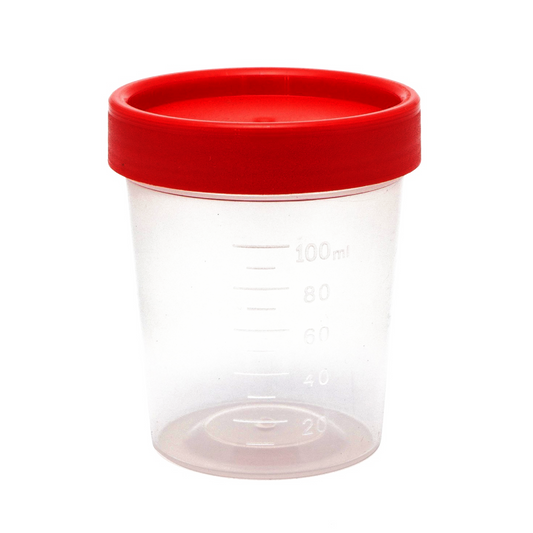 Envases para Heces y Orina